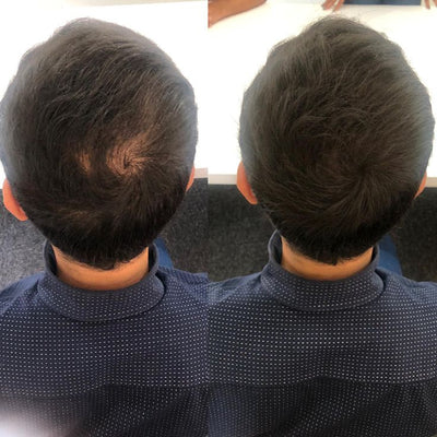 Customer review photo