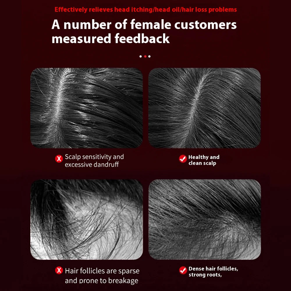 FollicBoost Scalp Massager Brush